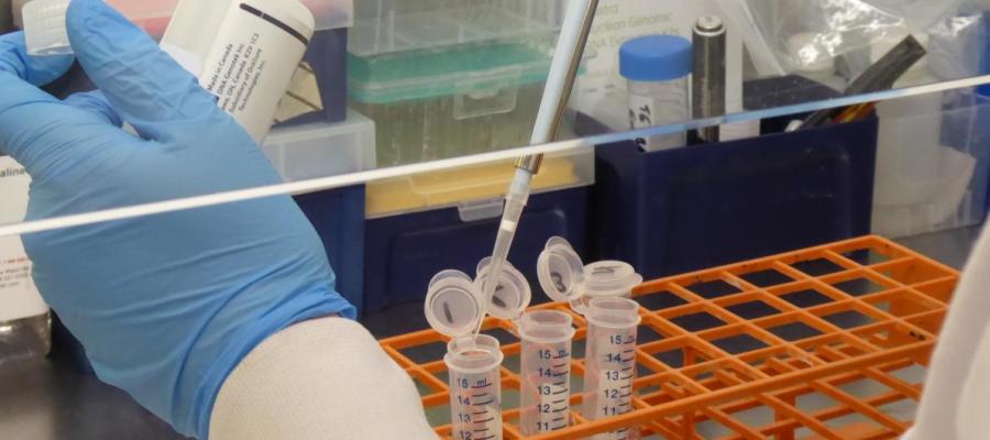 Scientist pipetting liquid into sample container